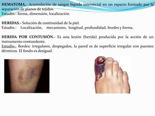 HEMATOMA.- Acumulación de sangre líquida intersticial en un espacio formado por la 
separación de planos de tejidos. 
Estudio.- forma, dimensión, localización. 
HERIDAS.- Solución de continuidad de la piel. 
Estudio.- Localización, mecanismo, longitud, profundidad, bordes y forma. 
HERIDA POR CONTUSIÓN.- Es una lesión (herida) producida por la acción de un 
instrumento contundente. 
Estudio.- Bordes: irregulares, despegados, la pared es de superficie irregular con puentes 
dérmicos. El fondo es desigual. 
 
