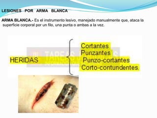 LESIONES POR ARMA BLANCA 
ARMA BLANCA.- Es el instrumento lesivo, manejado manualmente que, ataca la 
superficie corporal por un filo, una punta o ambas a la vez. 
 