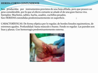 HERIDA CORTO CONTUNDENTE 
Son producidas por instrumentos provistos de una hoja afilada, pero que poseen un 
peso considerable, por lo que al efecto cortante se añade el de una gran fuerza viva. 
Ejemplos: Machetes, sables, hacha, azadón, cuchillos pesados. 
Son HERIDAS extendidas predominantemente en superficie. ; 
CARACTERÍSTICAS: De forma elíptica por lo regular, de bordes lineales equimoticos, de 
extremos agudos. Profundidad: hasta músculo o hueso. Fondo es regular. Las paredes son 
lisas y planas. Con hemorragia predominantemente externa. 
 