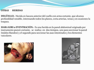 OTRAS HERIDAS 
DEGÜELLO.- Herida en lascara anterior del cuello con arma cortante, que alcanza 
profundidad notable, interesando todos los planos, corta arterias, venas y en ocasiones la 
traquea. 
HARA KIRI o EVENTRACIÓN.- Es una herida en la pared abdominal originada por 
instrumento punzó-cortante, se realiza en dos tiempos, uno para seccionar la pared 
(tejidos blandos) y el segundo para seccionar las asas intestinales y los elementos 
vasculares. 
 