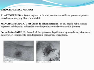 CARACTERES SECUNDARIOS 
CUARTO DE MINA.- Restos negruzcos (humo, partículas metálicas, granos de pólvora, 
mezclada de sangre y fibras de vestido). 
MANCHAS NEGRAS O GRIS (zona de difuminación).- Es una areola nebulosa que 
representa el depósito pulverulento de los productos de la combustión (humo). 
Secundarios TATUAJE.- Procede de los granos de la pólvora no quemada, cuya fuerza de 
penetración es suficiente para desgarrar la epidermis e incrustarse. 
 