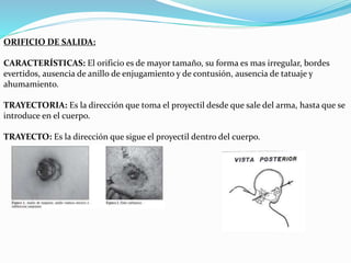ORIFICIO DE SALIDA: 
CARACTERÍSTICAS: El orificio es de mayor tamaño, su forma es mas irregular, bordes 
evertidos, ausencia de anillo de enjugamiento y de contusión, ausencia de tatuaje y 
ahumamiento. 
TRAYECTORIA: Es la dirección que toma el proyectil desde que sale del arma, hasta que se 
introduce en el cuerpo. 
TRAYECTO: Es la dirección que sigue el proyectil dentro del cuerpo. 
 