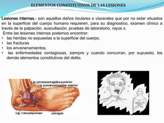 ELEMENTOS CONSTITUTIVOS DE LAS LESIONES 
Lesiones internas.- son aquellos daños tisulares o viscerales que por no estar situados 
en la superficie del cuerpo humano requieren, para su diagnostico, examen clínico a 
través de la palpación, auscultación, pruebas de laboratorio, rayos x. 
Entre las lesiones internas podemos encontrar: 
• las heridas no expuestas a la superficie del cuerpo, 
• las fracturas 
• los envenenamientos, 
• las enfermedades contagiosas, siempre y cuando concurran, por supuesto, los 
demás elementos constitutivos del delito. 
 