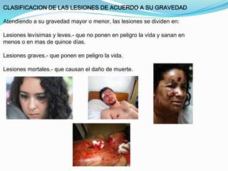 CLASIFICACION DE LAS LESIONES DE ACUERDO A SU GRAVEDAD 
Atendiendo a su gravedad mayor o menor, las lesiones se dividen en: 
Lesiones levísimas y leves.- que no ponen en peligro la vida y sanan en 
menos o en mas de quince días. 
Lesiones graves.- que ponen en peligro la vida. 
Lesiones mortales.- que causan el daño de muerte. 
 