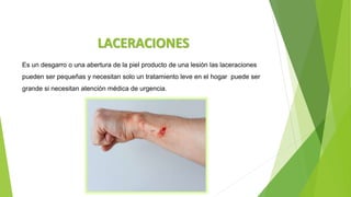 lesiones-pptx