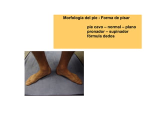 Morfología del pie - Forma de pisar pie cavo – normal – plano pronador – supinador fórmula dedos  