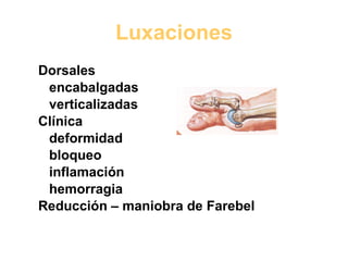 Luxaciones Dorsales encabalgadas verticalizadas Clínica deformidad bloqueo inflamación hemorragia Reducción – maniobra de Farebel 