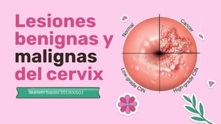 Lesiones
benignas y
malignas
del cervix
 