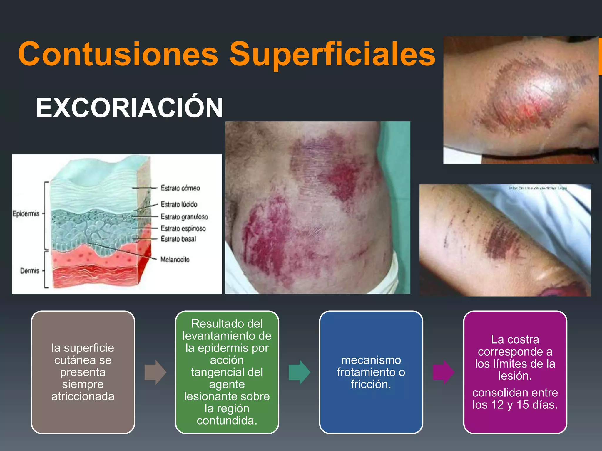 Lesiones contusas | PPT