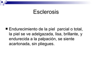Esclerosis Endurecimiento de la piel  parcial o total, la piel se ve adelgazada, lisa, brillante, y endurecida a la palpación, se siente acartonada, sin pliegues. 