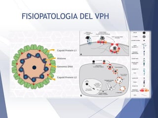 FISIOPATOLOGIA DEL VPH
 