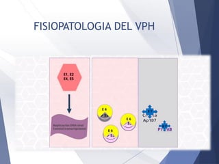 FISIOPATOLOGIA DEL VPH
 