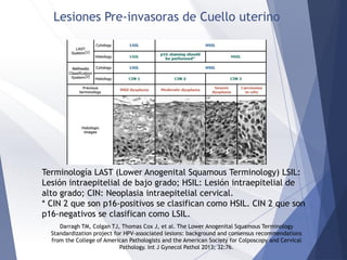 Lesiones Pre-invasoras de Cuello uterino
Terminología LAST (Lower Anogenital Squamous Terminology) LSIL:
Lesión intraepitelial de bajo grado; HSIL: Lesión intraepitelial de
alto grado; CIN: Neoplasia intraepitelial cervical.
* CIN 2 que son p16-positivos se clasifican como HSIL. CIN 2 que son
p16-negativos se clasifican como LSIL.
Darragh TM, Colgan TJ, Thomas Cox J, et al. The Lower Anogenital Squamous Terminology
Standardization project for HPV-associated lesions: background and consensus recommendations
from the College of American Pathologists and the American Society for Colposcopy and Cervical
Pathology. Int J Gynecol Pathol 2013; 32:76.
 