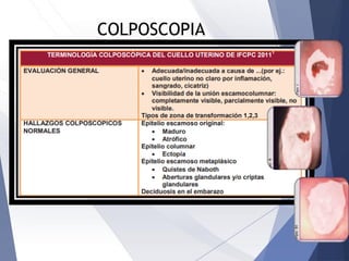 COLPOSCOPIA
 