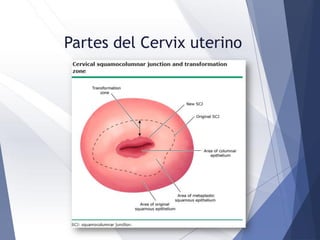 Partes del Cervix uterino
 