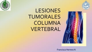 LESIONES
TUMORALES
COLUMNA
VERTEBRAL
Francisca Herrera N.
 
