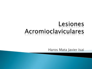 Lesiones AcromioclavicularesHaros Mata Javier Isai