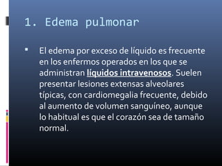 1. Edema pulmonar
 El edema por exceso de líquido es frecuente
en los enfermos operados en los que se
administran líquidos intravenosos. Suelen
presentar lesiones extensas alveolares
típicas, con cardiomegalia frecuente, debido
al aumento de volumen sanguíneo, aunque
lo habitual es que el corazón sea de tamaño
normal.
 