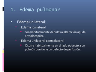 1. Edema pulmonar
 Edema unilateral:
 Edema ipsilateral
 son habitualmente debidas a alteración aguda
alveolocapilar.
 Edema unilateral contralateral
 Ocurre habitualmente en el lado opuesto a un
pulmón que tiene un defecto de perfusión.
 