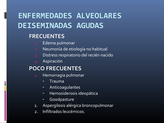 ENFERMEDADES ALVEOLARES
DEISEMINADAS AGUDAS
FRECUENTES
1. Edema pulmonar
2. Neumonía de etiología no habitual
3. Distress respiratorio del recién nacido
4. Aspiración
POCO FRECUENTES
1. Hemorragia pulmonar
­ Trauma
­ Anticoagulantes
­ Hemosiderosis ideopática
­ Goodpasture
1. Aspergilosis alérgica broncopulmonar
2. Infiltrados leucémicos.
 