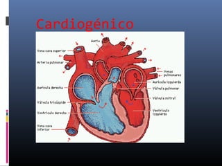 Cardiogénico
 