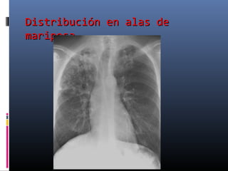Distribución en alas deDistribución en alas de
mariposamariposa
 