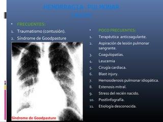 HEMORRAGIA PULMONAR
CAUSAS
• FRECUENTES:
1. Traumatismo (contusión).
2. Síndrome de Goodpasture
Síndrome de Goodpasture
• POCO FRECUENTES:
1. Terapéutica anticoagulante.
2. Aspiración de lesión pulmonar
sangrante.
3. Coagulopatías.
4. Leucemia
5. Cirugía cardiaca.
6. Blast injury.
7. Hemosiderosis pulmonar idiopática.
8. Estenosis mitral.
9. Stress del recién nacido.
10. Postlinfografía.
11. Etiología desconocida.
 