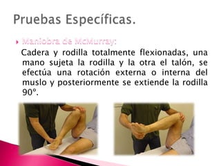 

La aparición de dolor al extender en rotación
externa indica lesión de menisco interno; en
rotación interna lesión del ...