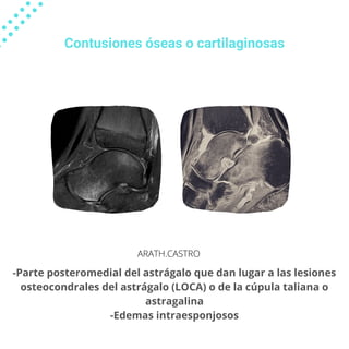 Lesiones Asociadas A Esguince De Tobillo PDF lesiones-asociadas-a-esguince-de-tobillo-pdf