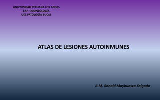 ATLAS DE LESIONES AUTOINMUNES 
UNIVERSIDAD PERUANA LOS ANDES 
EAP ODONTOLOGÍA 
UEC PATOLOGÍA BUCAL 
R.M. Ronald Mayhuasca Salgado  