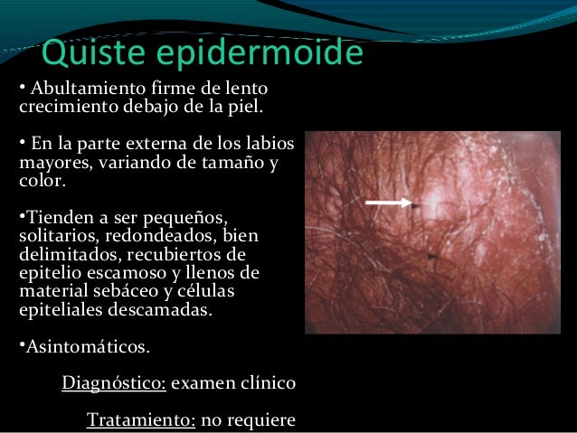 New Techniques in Anal Fistula Management - Annals of ...