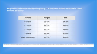 4cm Rcc Comprehensive Overview of Benign and Malignant Renal and Bladder ...