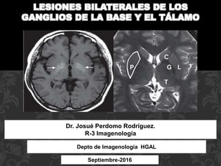 LESIONES BILATERALES DE LOS
GANGLIOS DE LA BASE Y EL TÁLAMO
Septiembre-2016
Dr. Josué Perdomo Rodríguez.
R-3 Imagenología
Depto de Imagenología HGAL
 