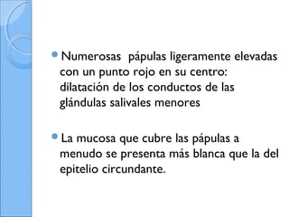Numerosas pápulas ligeramente elevadas
con un punto rojo en su centro:
dilatación de los conductos de las
glándulas salivales menores
La mucosa que cubre las pápulas a
menudo se presenta más blanca que la del
epitelio circundante.
 