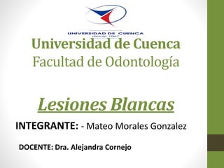 Universidad de Cuenca
Facultad de Odontología
Lesiones Blancas
INTEGRANTE: - Mateo Morales Gonzalez
DOCENTE: Dra. Alejandra Cornejo
 