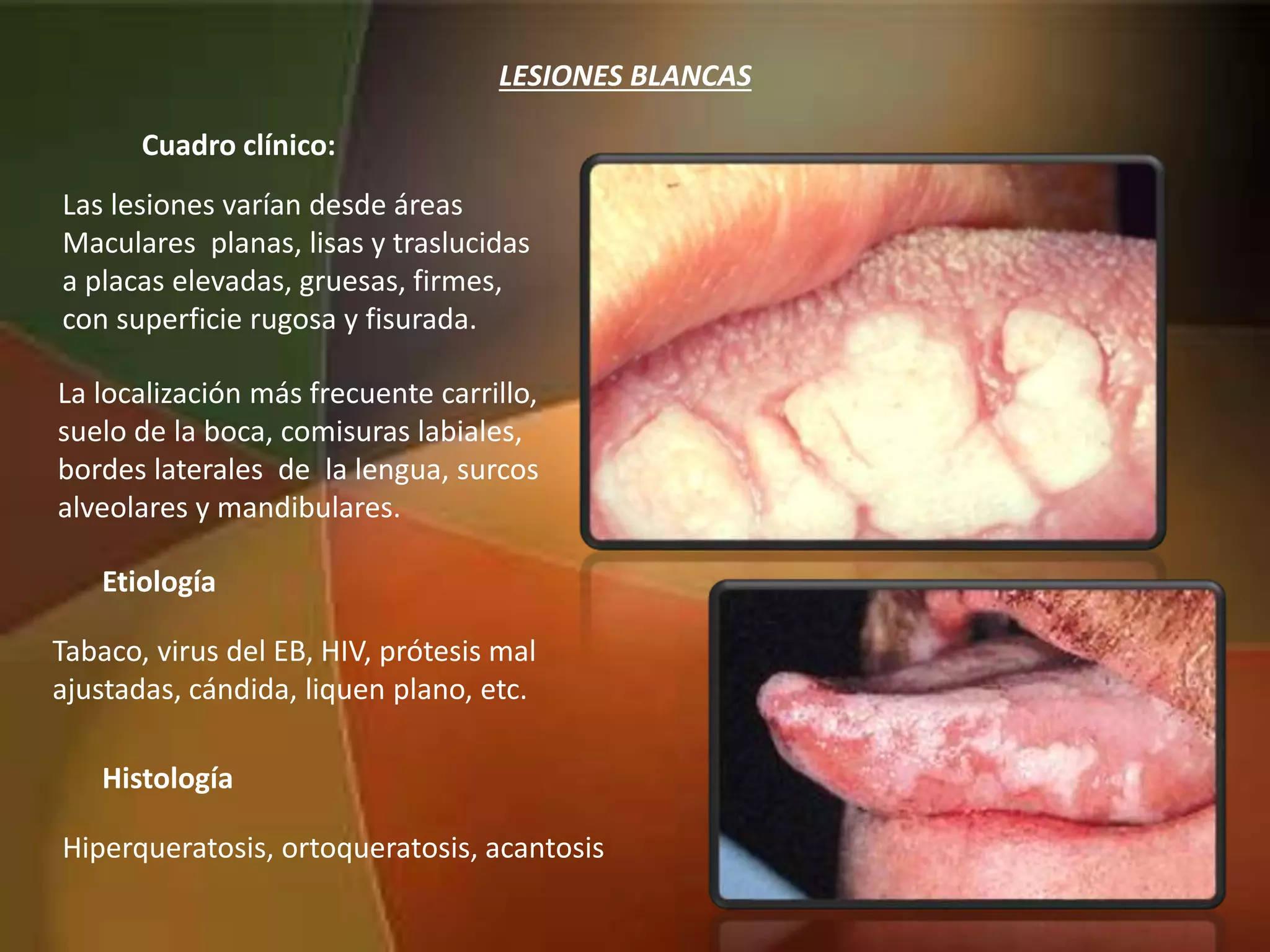 Lesiones Blancas Y Reactivas PPTX lesiones-blancas-y-reactivas-pptx