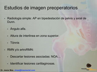 Estudios de imagen preoperatorios
• Radiologia simple: AP en bipedestación de pelvis y axial de
Dunn.
• Ángulo alfa.
• Altura de interlinea en zona superior.
• Tönnis
• RMN y/o artroRMN:
• Descartar lesiones asociadas: NOA…
• Identificar lesiones cartilaginosas.
Dr. Jesús Mas. Jmas@traumavist.com
 