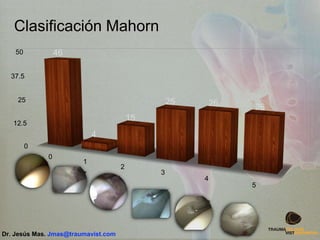 Clasificación Mahorn
0
12.5
25
37.5
50
0
1
2
3
4
5
46
4
15
25 26 26
Dr. Jesús Mas. Jmas@traumavist.com
 