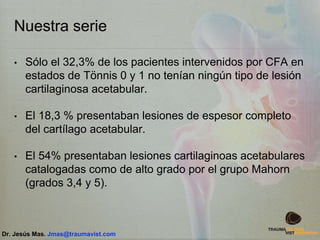 Nuestra serie
• Sólo el 32,3% de los pacientes intervenidos por CFA en
estados de Tönnis 0 y 1 no tenían ningún tipo de lesión
cartilaginosa acetabular.
• El 18,3 % presentaban lesiones de espesor completo
del cartílago acetabular.
• El 54% presentaban lesiones cartilaginoas acetabulares
catalogadas como de alto grado por el grupo Mahorn
(grados 3,4 y 5).
Dr. Jesús Mas. Jmas@traumavist.com
 