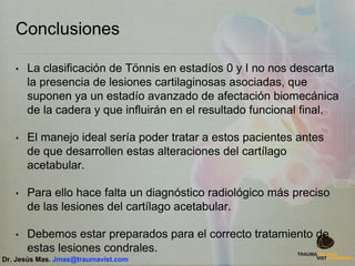 Conclusiones
• La clasificación de Tönnis en estadíos 0 y I no nos descarta
la presencia de lesiones cartilaginosas asociadas, que
suponen ya un estadío avanzado de afectación biomecánica
de la cadera y que influirán en el resultado funcional final.
• El manejo ideal sería poder tratar a estos pacientes antes
de que desarrollen estas alteraciones del cartílago
acetabular.
• Para ello hace falta un diagnóstico radiológico más preciso
de las lesiones del cartílago acetabular.
• Debemos estar preparados para el correcto tratamiento de
estas lesiones condrales.
Dr. Jesús Mas. Jmas@traumavist.com
 