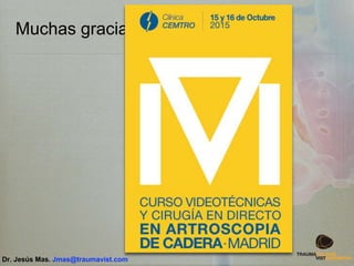 Muchas gracias!!
Dr. Jesús Mas. Jmas@traumavist.com
 