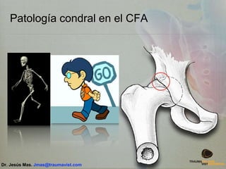Patología condral en el CFA
Dr. Jesús Mas. Jmas@traumavist.com
 