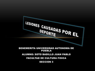 BENEMERITA UNIVERSIDAD AUTONOMA DE
PUEBLA
ALUMNO: SOTO BADILLO JUAN PABLO
FACULTAD DE CULTURA FISICA
SECCION 3
 