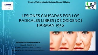 LESIONES CAUSADAS POR LOS
RADICALES LIBRES (DE OXIGENO)
HARMAN 1956
ESTOMATOLOGIA GERIATRICA
GRADO: 7 GRUPO: B
ALUMNA: DIANA MARTIN SANTIAGO
DOCENTE: MTRO. PEDRO MACBANI OLVERA
Centro Universitario Metropolitano Hidalgo
1
 