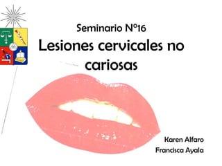 Seminario N°16
Lesiones cervicales no
cariosas
Karen Alfaro
Francisca Ayala
 