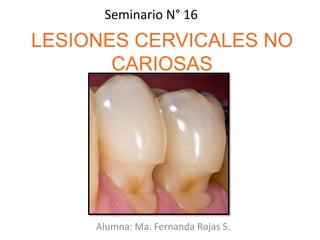 LESIONES CERVICALES NO
CARIOSAS
Alumna: Ma. Fernanda Rojas S.
Seminario N° 16
 