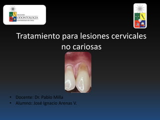Tratamiento para lesiones cervicales
no cariosas
• Docente: Dr. Pablo Milla
• Alumno: José Ignacio Arenas V.
 
