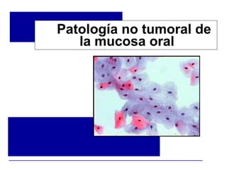 Patología oral
Patología no tumoral de
la mucosa oral
 