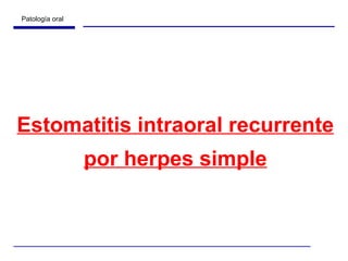 Estomatitis intraoral recurrente por herpes simple 