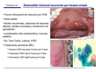 Estomatitis intraoral recurrente por herpes simple Forma infrecuente de infección por VHS  Edad adulta Brotes recurrentes, dolorosos de lesiones aftosas, bordes circinados y tendencia a la agrupación Localización más característica: mucosa palatina Dx: Test Tzank, cultivos, PCR Tratamiento (primeras 48h):  Aciclovir 200 mg cada 4 horas por 5 días Valaciclovir 500 mg/12 horas por 5 días Famciclovir 250 mg/8 horas por 5 días 